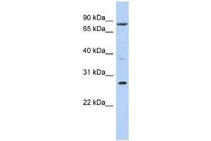 Western Blot showing KLF12 antibody used at a concentration of 1-2 ug/ml to detect its target protein. (KLF12 anticorps  (N-Term))