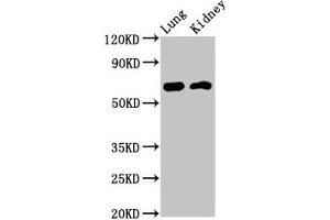 Western Blot Positive WB detected in: Rat lung tissue, Mouse kidney tissue All lanes: IQCB1 antibody at 3. (IQCB1 anticorps  (AA 445-598))