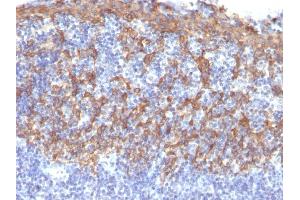 Formalin-fixed, paraffin-embedded human Tonsil stained with Cytokeratin 14 Mouse Monoclonal Antibody (LL002).