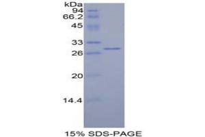 SDS-PAGE analysis of Mouse Mindbomb Homolog 2 Protein. (MIB2 Protéine)