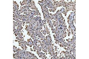 IHC analysis of HOXC4 using anti-HOXC4 antibody (ABIN7603059). (HOXC4 anticorps  (Middle Region))