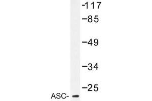 Image no. 2 for anti-PYD and CARD Domain Containing (PYCARD) antibody (ABIN272291) (PYCARD anticorps)