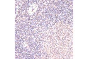 Immunohistochemistry of paraffin-embedded rat spleen using HSF1 antibody (ABIN6131141, ABIN6142021, ABIN6142022 and ABIN6217875) at dilution of 1:100 (40x lens). (HSF1 anticorps  (AA 350-529))