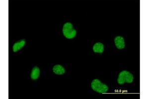 Immunofluorescence of purified MaxPab antibody to POLR3C on HeLa cell.