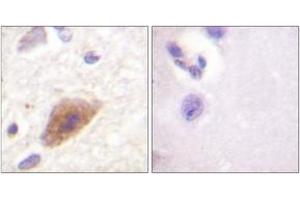 Immunohistochemistry (IHC) image for anti-Tyrosine Hydroxylase (TH) (AA 5-54) antibody (ABIN2888712) (Tyrosine Hydroxylase anticorps  (AA 5-54))