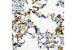 Anti-RAGE antibody, IHC(P) IHC(P): Rat Lung Tissue (RAGE anticorps  (Middle Region))