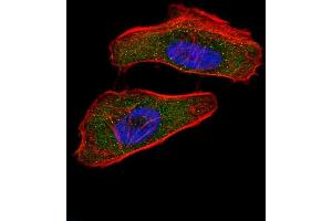 Fluorescent confocal image of Hela cell stained with HIF1A Antibody (N-term) (ABIN650972 and ABIN2840017).