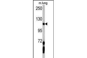 Western blot analysis of PDGFRA antibody (C-term ) (ABIN392022 and ABIN2841798) in mouse lung tissue lysates (35 μg/lane). (PDGFRA anticorps  (C-Term))