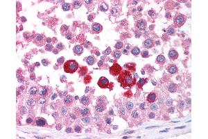 Anti-CHEK2 / CHK2 antibody IHC of human testis.