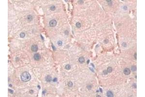 DAB staining on IHC-P; Samples: Human Liver Tissue