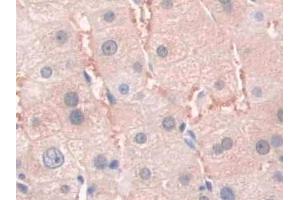 DAB staining on IHC-P; Samples: Human Liver Tissue (SFRP4 anticorps  (AA 25-222))