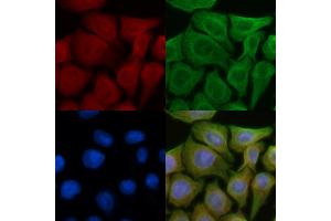 ABIN6257173 and ABIN6274284 staining Hela cells(45 min of heat-shock) by IF/ICC. (Ephrin A3 anticorps  (C-Term))