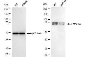 Western blotting analysis using MARK2 antibody (ABIN7799333).