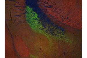 Indirect immunostaining of PFA fixed mouse brain section with anti-SV 2C (dilution 1 : 200; green) and rabbit anti-endophilin (cat.