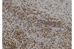 ABIN6261818 and ABIN6278680 at 1/100 staining Human spleen tissue by IHC-P. (FSBP anticorps  (Internal Region))