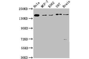 Western Blot Positive WB detected in: Hela whole cell lysate, MCF-7 whole cell lysate, K562 whole cell lysate, U87 whole cell lysate, Rat brain tissue All lanes: RAD54L2 antibody at 3. (ARIP4 anticorps  (AA 1122-1296))