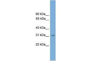 Human 721_B; WB Suggested Anti-SPRY3 Antibody Titration: 0. (SPRY3 anticorps  (N-Term))
