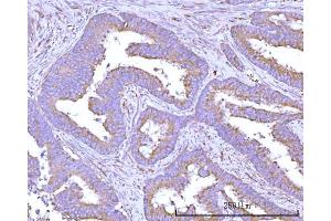 IHC analysis of RPS15A using anti-RPS15A antibody (ABIN7598954).