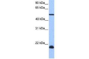 Western Blotting (WB) image for anti-Dyslexia Susceptibility 1 Candidate 1 (DYX1C1) antibody (ABIN2459540) (DYX1C1 anticorps)