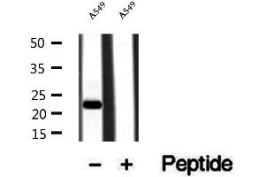 Western blot analysis of extracts of A549 cells, using PPPDE1/PNAS4 antibody. (PPPDE1 anticorps  (Internal Region))
