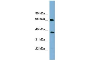 WB Suggested Anti-GNL3 Antibody Titration: 0. (Nucleostemin anticorps  (Middle Region))