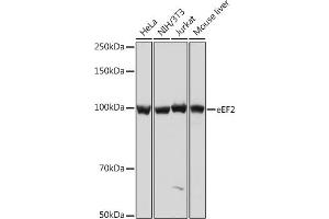 Western blot analysis of extracts of various cell lines, using eEF2 Rabbit mAb (ABIN7267025) at 1:1000 dilution.
