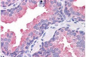 Human Prostate: Formalin-Fixed, Paraffin-Embedded (FFPE) (TMEM184A anticorps  (C-Term))