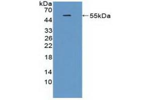 Detection of Recombinant TREM2, Rat using Polyclonal Antibody to Triggering Receptor Expressed On Myeloid Cells 2 (TREM2) (TREM2 anticorps  (AA 1-228))