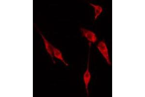 ABIN6274614 staining Hela cells by IF/ICC.