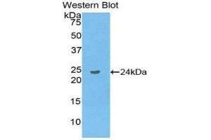 Western Blotting (WB) image for anti-Linker For Activation of T Cells Family, Member 2 (LAT2) (AA 30-209) antibody (ABIN1859616) (LAT2 anticorps  (AA 30-209))