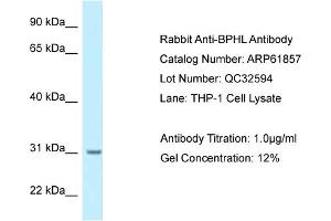 Western Blotting (WB) image for anti-Biphenyl Hydrolase-Like (Serine Hydrolase) (BPHL) (N-Term) antibody (ABIN2788926) (BPHL anticorps  (N-Term))