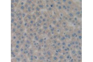 IHC-P analysis of Rat Tissue, with DAB staining. (CD11b anticorps  (AA 598-700))