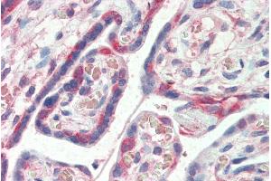 ABIN185153 (5µg/ml) staining of paraffin embedded Human Placenta. (PDLIM1 anticorps  (C-Term))