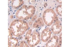 Used in DAB staining on fromalin fixed paraffin- embedded Kidney tissue