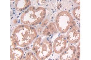 Used in DAB staining on fromalin fixed paraffin- embedded Kidney tissue (NCK1 anticorps  (AA 2-377))