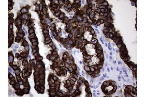 Immunohistochemistry (IHC) image for anti-Keratin Acidic (AE1) antibody (ABIN2715666)