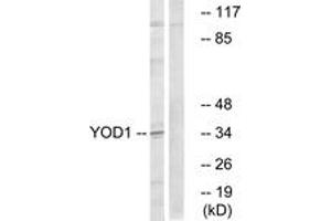 Western blot analysis of extracts from COLO cells, using YOD1 Antibody. (YOD1 anticorps  (AA 116-165))