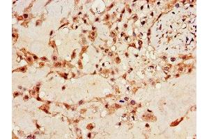 Immunohistochemistry of paraffin-embedded human placenta tissue using ABIN7156360 at dilution of 1:100 (IGF2BP3 anticorps  (AA 1-100))