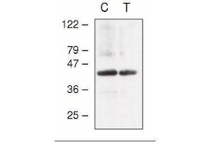 Western blot analysis of Arabidopsis chloroplast (C) and thylakoid (T) proteins with anti-CF1gamma (AtpC). (ATP Synthase Subunit gamma (AtpC) anticorps)