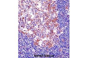 Immunohistochemistry (IHC) image for anti-Spleen Focus Forming Virus (SFFV) Proviral Integration Oncogene Spi1 (SPI1) antibody (ABIN2998289) (SPI1 anticorps)