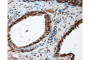 Immunohistochemical staining of paraffin-embedded liver tissue using anti-LIPG mouse monoclonal antibody. (LIPG anticorps)