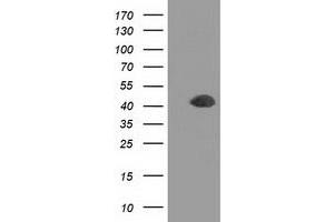 Western Blotting (WB) image for anti-Doublecortin (DCX) antibody (ABIN1497783) (Doublecortin anticorps)