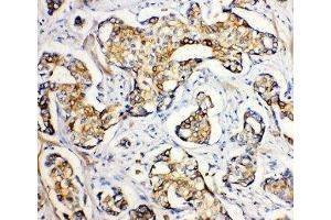 Anti-SERCA2 ATPase antibody, IHC(P) IHC(P): Human Mammary Cancer Tissue