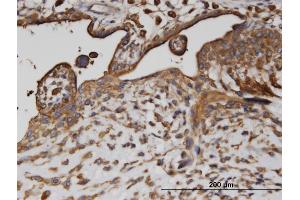 Immunoperoxidase of monoclonal antibody to AP2B1 on formalin-fixed paraffin-embedded human placenta.