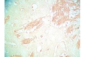 Mouse brain tissue was stained by Rabbit Anti-Metasin (1-25) / KISS-1 (68-92) (Human) Serum (KISS1 anticorps  (AA 1-25, AA 68-92))