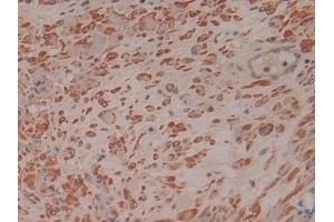 Detection of RI in Human Prostate Tissue using Polyclonal Antibody to Ribonuclease Inhibitor (RI)