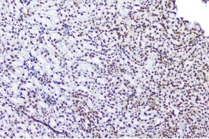 IHC analysis of TPR using anti-TPR antibody (ABIN5693275). (TPR anticorps)