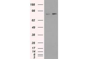 Western Blotting (WB) image for anti-Neurotrophic tyrosine Kinase, Receptor, Type 3 (NTRK3) antibody (ABIN1499843)