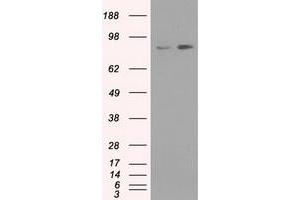 Western Blotting (WB) image for anti-Neurotrophic tyrosine Kinase, Receptor, Type 3 (NTRK3) antibody (ABIN1499843) (NTRK3 anticorps)