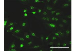 Immunofluorescence of monoclonal antibody to CITED1 on HeLa cell. (CITED1 anticorps  (AA 1-193))